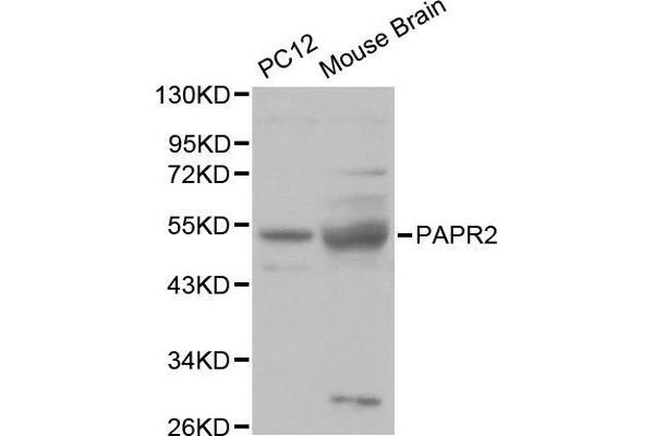 Parkin antibody  (AA 1-300)