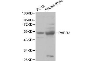 Western blot analysis of various cell lines, using PARK2 antibody.