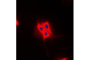 Immunofluorescent analysis of AS160 (pT642) staining in Raw264. (TBC1D4 antibody  (pSer642))