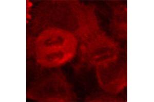 Immunofluorescence staining of methanol-fixed HeLa cells using Phospho-MAP2K2-T394 antibody (ABIN2987359). (MEK2 antibody  (pThr394))