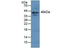 Detection of MAPK11 in Human Brain Tissue using Polyclonal Antibody to Mitogen Activated Protein Kinase 11 (MAPK11) (MAPK11 antibody  (AA 38-277))