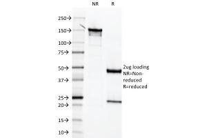 SDS-PAGE Analysis Purified Mesothelin Mouse Monoclonal Antibody (MSLN/2131). (Mesothelin antibody  (AA 273-407))