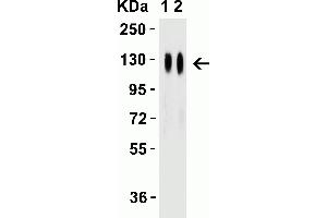 Western Blot Validation with SARS-CoV-2 (COVID-19) Spike Recombinant Protein Loading: 50 ng per lane of SARS-CoV-2 (COVID-19) Spike S1 recombinant protein (97-087). (SARS-CoV-2 Spike antibody  (RBD))
