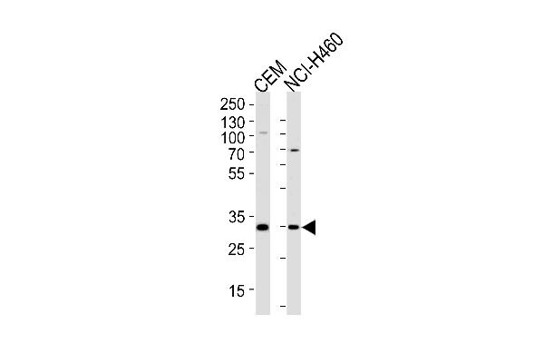 H2AFY2 Antikörper  (AA 148-169)