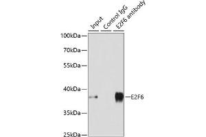 Immunoprecipitation analysis of 200 μg extracts of MCF-7 cells using 3 μg E2F6 antibody (ABIN1679632, ABIN1679631, ABIN5664137 and ABIN6219769). (E2F6 antibody  (AA 1-281))