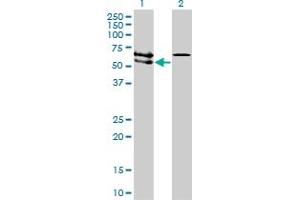 Western Blot analysis of ACVRL1 expression in transfected 293T cell line by ACVRL1 monoclonal antibody (M01), clone 5B1.
