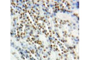 Used in DAB staining on fromalin fixed paraffin-embedded Kidney tissue (Vitamin D Receptor antibody  (AA 266-422))