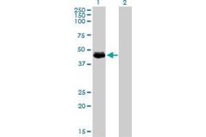 Western Blot analysis of TGFB1I1 expression in transfected 293T cell line by TGFB1I1 monoclonal antibody (M01), clone 4B2-D8. (TGFB1I1 antibody  (AA 1-444))