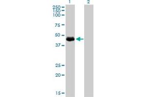 Western Blotting (WB) image for anti-Transforming Growth Factor beta 1 Induced Transcript 1 (TGFB1I1) (AA 1-444) antibody (ABIN563174)