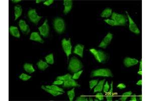 Immunofluorescence of monoclonal antibody to RPL36A on HeLa cell. (RPL36A antibody  (AA 7-106))