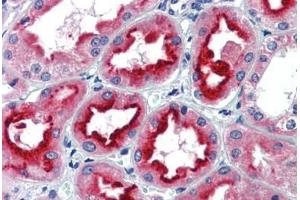 Human Kidney (formalin-fixed, paraffin-embedded) stained with SIN3A antibody ABIN462178 followed by biotinylated goat anti-rabbit IgG secondary antibody ABIN481713, alkaline phosphatase-streptavidin and chromogen. (SIN3A antibody  (N-Term))