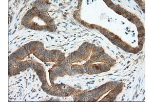 Image no. 3 for anti-Transforming, Acidic Coiled-Coil Containing Protein 3 (TACC3) antibody (ABIN1498098) (TACC3 antibody)