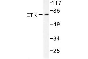 Image no. 1 for anti-BMX Non-Receptor Tyrosine Kinase (BMX) antibody (ABIN272022) (BMX antibody)