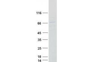 Western Blotting (WB) image for T-Complex Protein 1 Subunit zeta-2-Like (CCT6B) protein (Myc-DYKDDDDK Tag) (ABIN2713339)