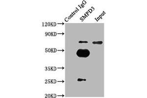 Immunoprecipitating SMPD3 in mouse brain whole cell lysate Lane 1: Rabbit control IgG (1 μg) instead of ABIN7170557 in mouse brain whole cell lysate. (SMPD3 antibody  (AA 401-655))