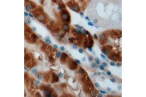 Immunohistochemical analysis of CPT2 staining in mouse kidney formalin fixed paraffin embedded tissue section. (CPT2 antibody)