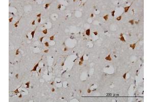 Image no. 3 for anti-Eukaryotic Translation Initiation Factor 2-alpha Kinase 2 (EIF2AK2) (AA 1-101) antibody (ABIN598900) (EIF2AK2 antibody  (AA 1-101))