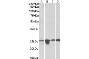 ABIN768566 (0. (SOD2 antibody  (AA 119-130))