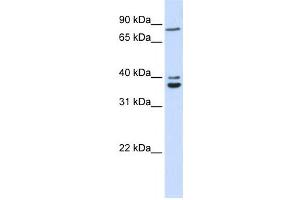 Western Blotting (WB) image for anti-Chromosome 18 Open Reading Frame 10 (C18orf10) antibody (ABIN2459872)