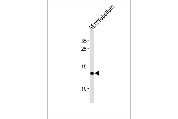 EIF1 antibody  (C-Term)