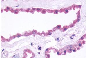 Anti-GRM3 / MGLUR3 antibody  ABIN1048932 IHC staining of human brain, coroid plexus. (Metabotropic Glutamate Receptor 3 antibody  (N-Term))