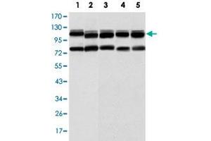 Western blot analysis of BMPR2 monoclonal antibody, clone 1F12  against HeLa (1), A-431 (2), NIH/3T3 (3), COS-7 (4) and PC-12 (5) cell lysate.