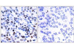 Image no. 2 for anti-Jun B Proto-Oncogene (JUNB) antibody (ABIN273763) (JunB antibody)