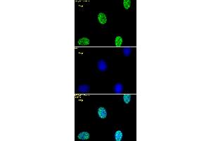 Histone H3K4me2 antibody (pAb) tested by immunofluorescence. (Histone 3 antibody  (2meLys4))