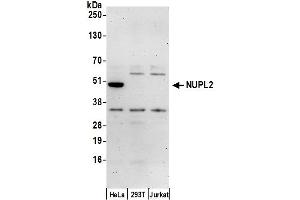 anti-Nucleoporin Like 2 (NUPL2) (AA 150-200) antibody