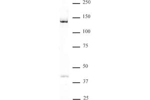 DDB1 antibody (pAb) tested by Western blot Nuclear extract of HeLa cells (30 μg) probed with DDB1 antibody (1:500). (DDB1 antibody  (C-Term))