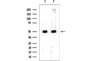 anti-GDP-Mannose Pyrophosphorylase B (GMPPB) antibody