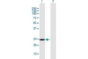 Western Blot analysis of SSX4 expression in transfected 293T cell line by SSX4 MaxPab polyclonal antibody. (SSX4 antibody  (AA 1-188))