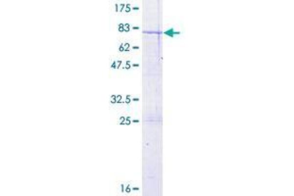 CCBL2 Protein (AA 1-454) (GST tag)