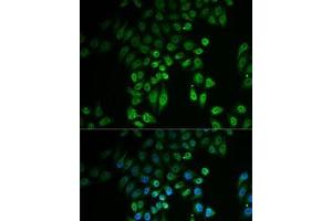 Immunofluorescence analysis of U2OS cells using GPLD1 Polyclonal Antibody (GPLD1 antibody)