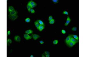 Immunofluorescence staining of HepG2 cells with ABIN7170862 at 1:100, counter-stained with DAPI. (SMC2 antibody  (AA 861-968))