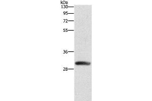 Western Blot analysis of Mouse heart tissue using DCK Polyclonal Antibody at dilution of 1:550 (DCK antibody)