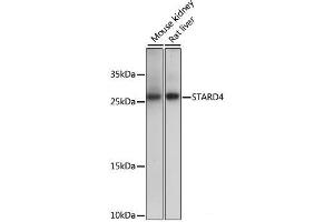 Western blot analysis of extracts of various cell lines using STARD4 Polyclonal Antibody at dilution of 1:1000. (STARD4 antibody)