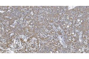 IHC analysis of CARD4/NOD1 using anti-CARD4/NOD1 antibody (ABIN7600975). (NOD1 antibody  (AA 26-953))