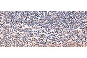 Immunohistochemistry of paraffin-embedded Human tonsil tissue using IFNA1:IFNA13 Polyclonal Antibody at dilution of 1:35(x200) (IFNA1 antibody)