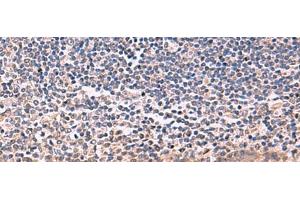 Immunohistochemistry of paraffin-embedded Human tonsil tissue using IFNA1:IFNA13 Polyclonal Antibody at dilution of 1:35(x200)