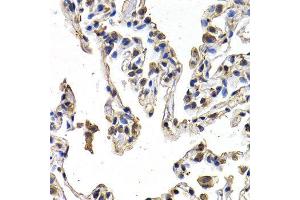 Immunohistochemistry (IHC) image for anti-C-Fos Induced Growth Factor (Vascular Endothelial Growth Factor D) (Figf) (AA 20-220) antibody (ABIN3021686) (VEGFD antibody  (AA 20-220))