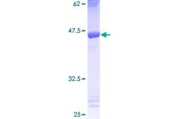 EIF5A Protein (AA 1-154) (GST tag)
