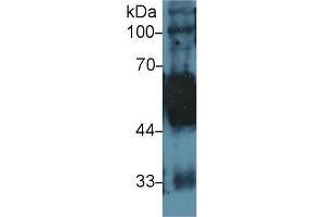Western Blotting (WB) image for anti-Keratin 5 (KRT5) (AA 166-474) antibody (ABIN1172966)