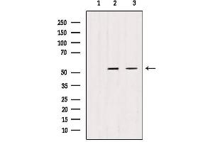 Western blot analysis of extracts from various samples, using TRIM44 antibody. (TRIM44 antibody  (Internal Region))