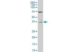 CD68 polyclonal antibody (A01), Lot # 060717JCS1. (CD68 antibody  (AA 164-262))