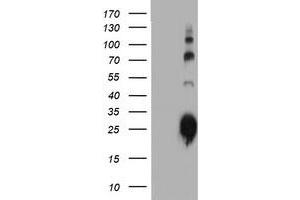 Western Blotting (WB) image for anti-Immunoglobulin J Polypeptide, Linker Protein For Immunoglobulin alpha and mu Polypeptides (IGJ) antibody (ABIN1498838) (IGJ antibody)