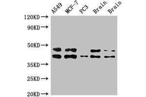 PRKACB antibody  (Catalytic Subunit beta)