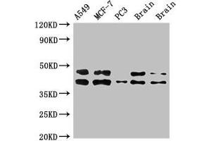 Western Blot Positive WB detected in: A549 whole cell lysate, MCF-7 whole cell lysate, PC-3 whole cell lysate, Rat brain tissue, Mouse brain tissue All lanes: PRKACB antibody at 3 μg/mL Secondary Goat polyclonal to rabbit IgG at 1/50000 dilution Predicted band size: 41, 47, 40, 42, 30, 37 kDa Observed band size: 41, 47 kDa