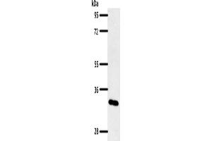 Gel: 10 % SDS-PAGE, Lysate: 50 μg, Lane: Mouse pancreas tissue, Primary antibody: ABIN7192464(SLC2A4RG Antibody) at dilution 1/400, Secondary antibody: Goat anti rabbit IgG at 1/8000 dilution, Exposure time: 1 minute (SLC2A4RG antibody)
