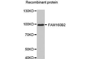 Western blot analysis of extracts of recombinant protein, using FAM160B2 antibody. (FAM160B2 antibody  (AA 420-520))